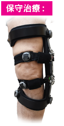 Brace image